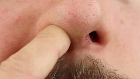 Man picks nose, right left nostrils, stuffy nose or loss smell, closeup macro Video stock 145535966