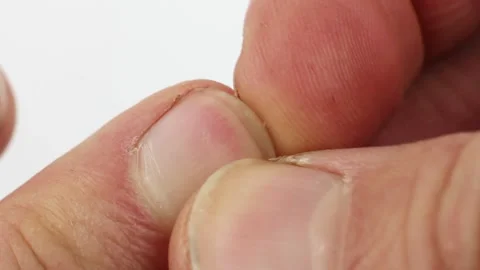 Man picks out dirt under nails or fingernails, close-up macro, white background Video stock 145535853