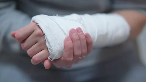 Man with plaster cast on arm. Difficulty of self-movement of hand at a fracture. Stock Footage 234050154