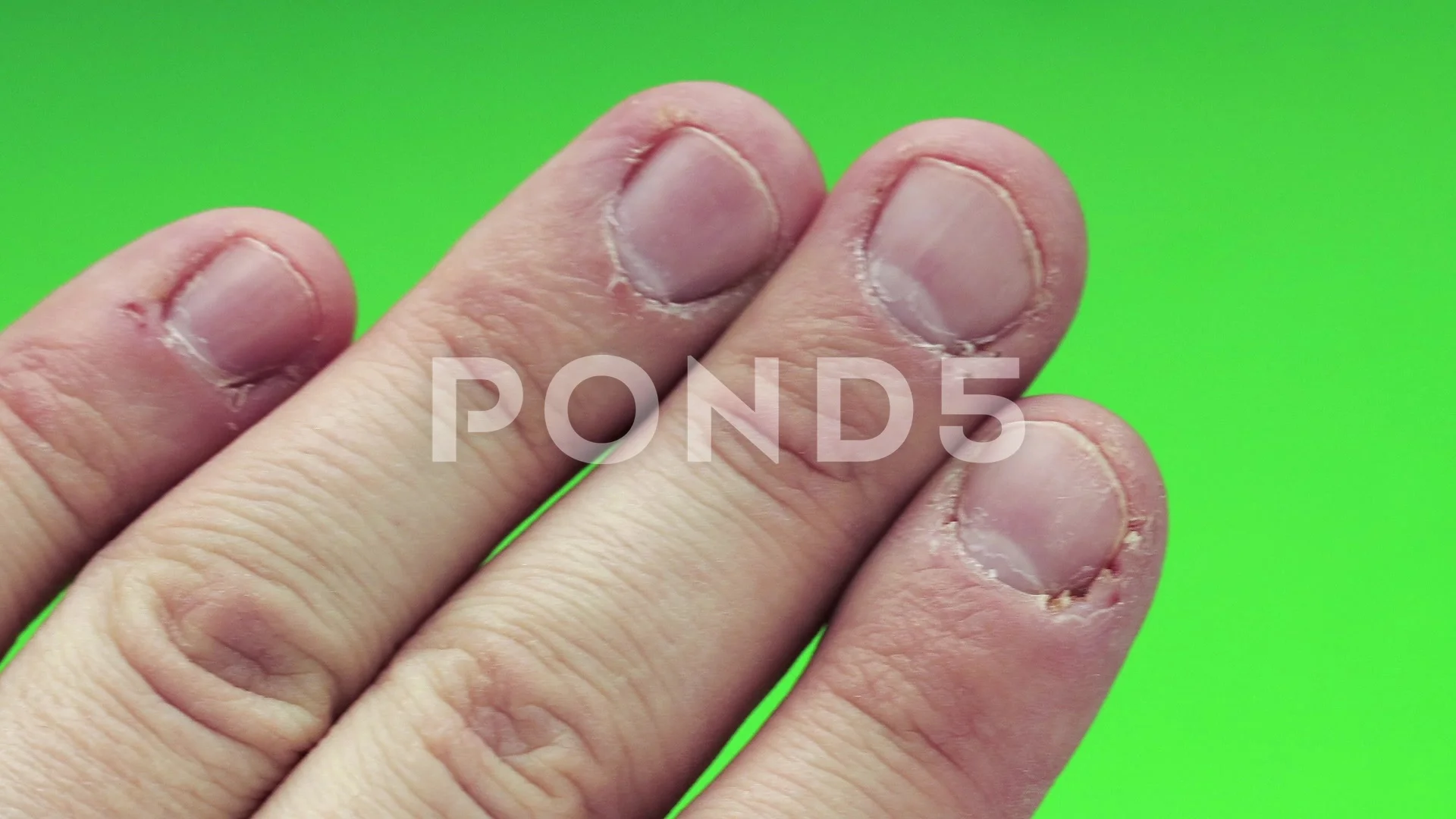 Man, problem hand with gnawed nails in p... | Stock Video | Pond5