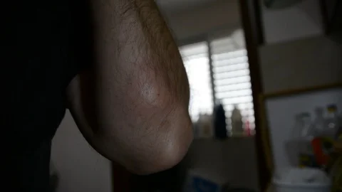 Man processes an insect bite on his hand Vídeos de archivo 128621458