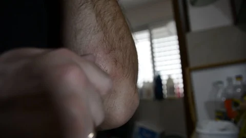 Man processes an insect bite on his hand Stock Footage 128621475