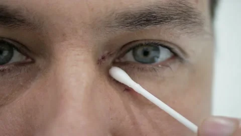 A man processes stitches on a wound after surgery Stock Footage 150679671