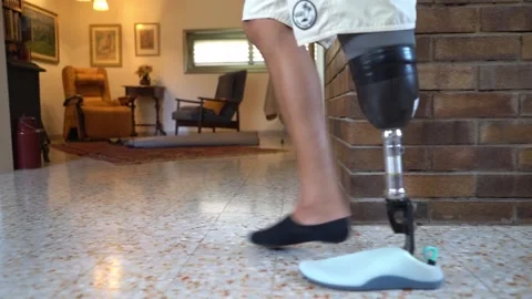 Man with prosthesis walking in his house Stockbeeldmateriaal 142618624