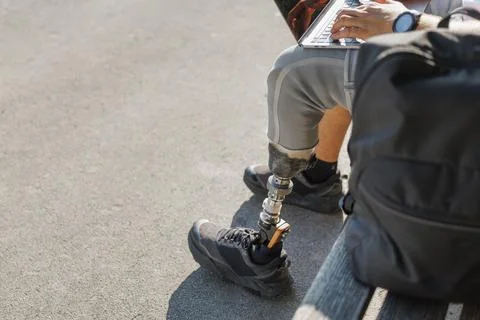 Man with a prosthetic leg using a laptop and smartphone while sitting outdoors 写真素材