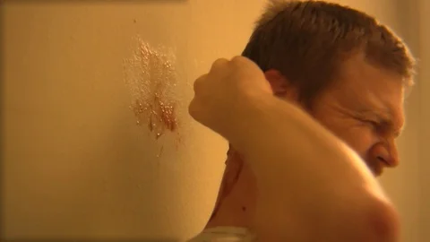 A man pulls at his head in hospital and blood comes out. Video stock 99607279