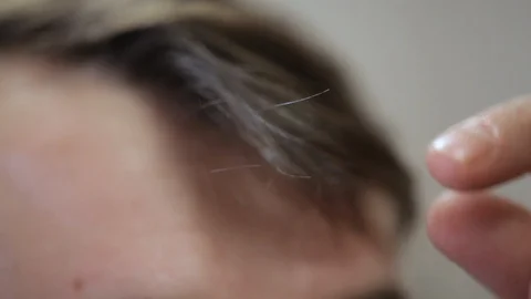 Man pulls out grey-haired hair Stock Footage 99796065