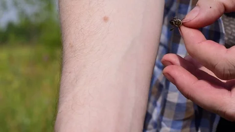 A man puts a bee on his hand and waits for it to sting him Stock Footage 92839310