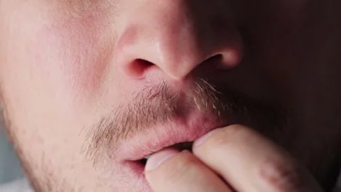 The man puts the mouth guard close up footage. Dental trainer for adults for the Stock Footage 327846484
