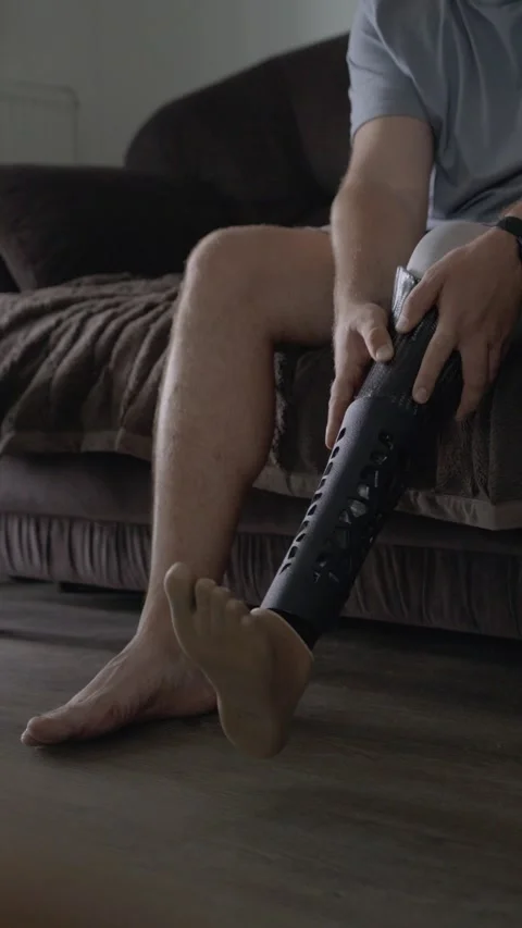 Man Putting On Modern Bionic Prosthetic Leg in Morning Stock-Footage 317899787