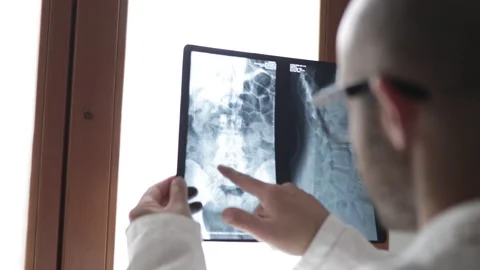 Man radiologist examining a spinal x-ray radiography in the lab Stock Footage 191606500