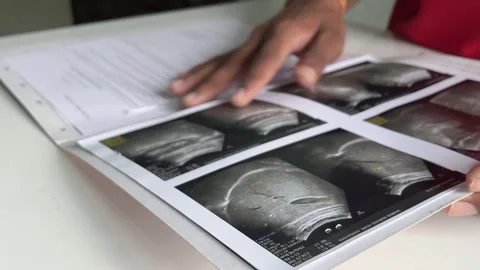 Man reading sonography report on table Stock Footage 315019093