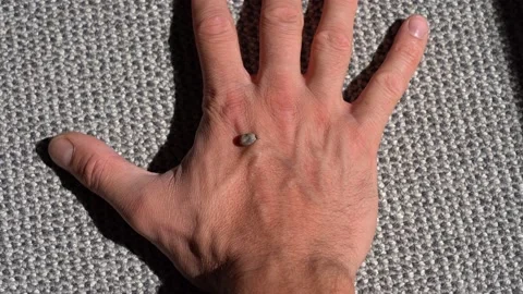 Man Remove Huge Tick Full of Blood Crawling On Male Human Hand Stock Footage 227183444