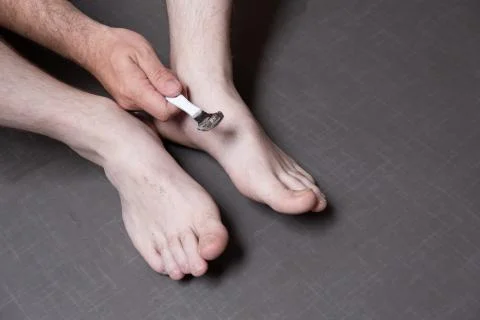 Man removing corn, callus from his feet using a razor file, masculine skin care Stock Photos