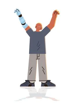 Man with replaced robotic arm guy with titanium implant or prosthesis hand Stock Illustration