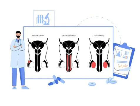 Man Reproducive System Problems Stock Illustration