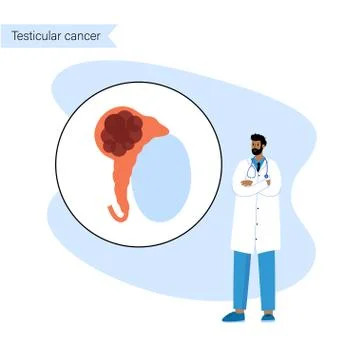 Man Reproducive System Problems Illustrazione stock