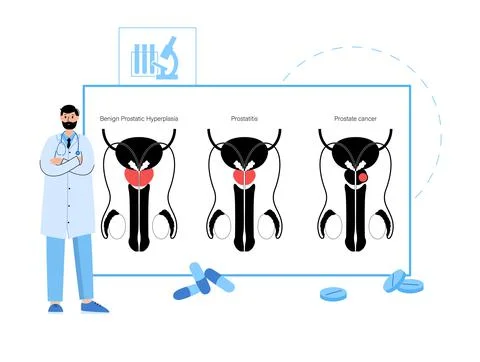 Man Reproducive System Problems Stock Illustration