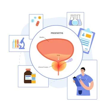 Man Reproducive System Problems Stock Illustration