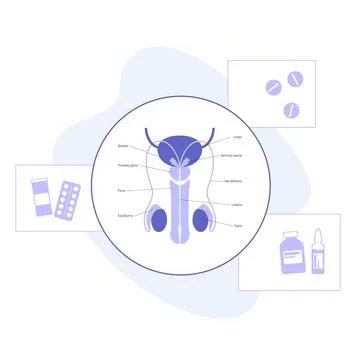 Man Reproducive System Problems Stock Illustration