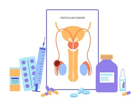 Man Reproducive System Problems Stock Illustration