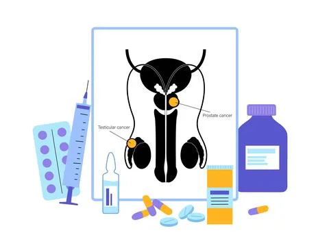 Man Reproducive System Problems Stock Illustration