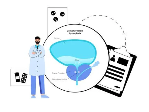 Man Reproducive System Problems Stock Illustration