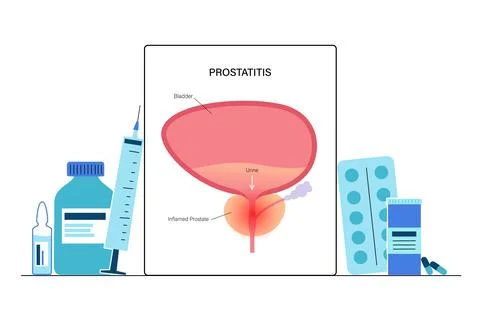 Man Reproducive System Problems Stock Illustration