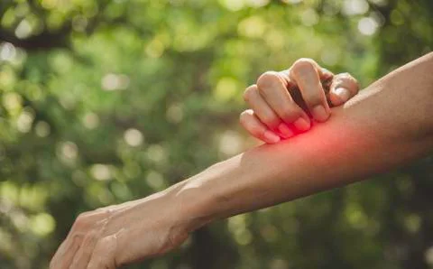 Man scratch itch with hand. Man scratching his hand healthcare concept. Stock Photos