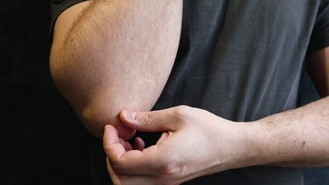 A man scratches a rough patch of skin on his elbow, a seasonal skin problem. 스톡 동영상 123536698