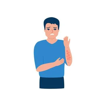 Man scratching arm, rash, allergy on hand, acne on skin. Male suffering from  Stock Illustration