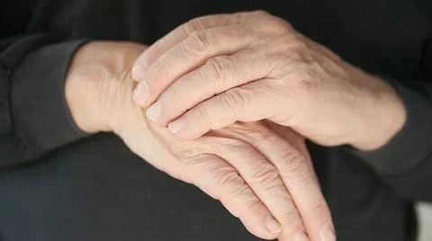 Man scratching eczema on hand Stock Footage 18193162