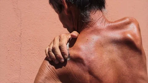 Man scratching himself due to eczema on his skin Stock Footage 112283394