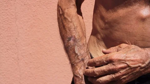 Man scratching himself due to eczema on his skin Stock Footage 112290143