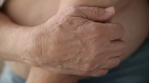 Man scratching his elbow Stock Footage 20522849