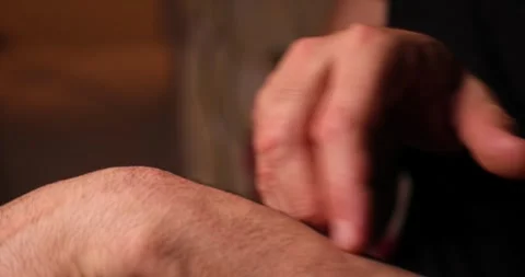 Man Scratching His Hands Due to Psoriasis or Eczema, Skin Disease and Itching Co 库存影片 328101623