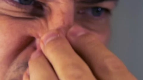 Man scratching nose close-up, touching face with irritation or discomfort Stock Footage 333478681