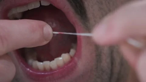 A man with sensitive gums flosses close up. Stock Footage 314477203