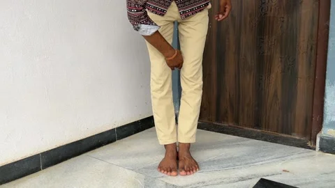 Man Showing Bow Legs Problem | Genu Varum Condition Video Видео 315337965