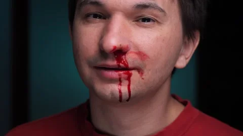 Man showing nose bleeding and blood covered mouth Stock Footage 306800157