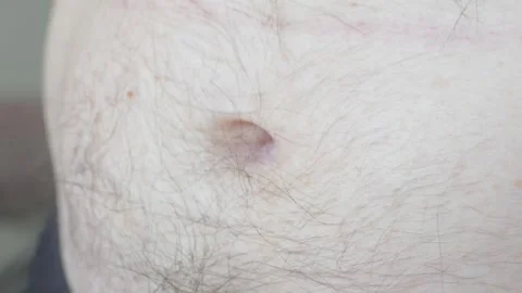 A man shows off his belly button on his hairy belly Stockbeeldmateriaal 284809961