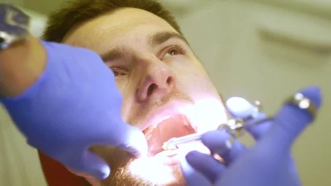 Man siting in dentist chair, pull up a tooth Stock Footage 81179837