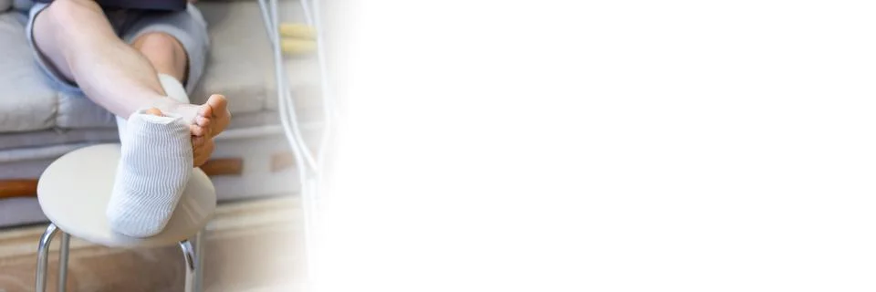 A man sits on a sofa in a cast with a laptop. Banner. Foto stock