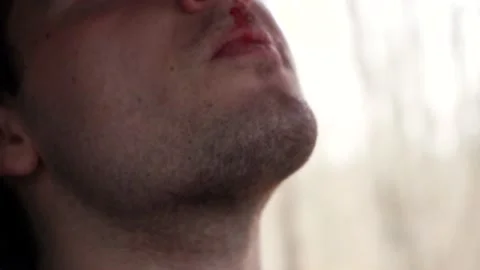 Man sitting in the car is bleeding from the nose Stock Footage 152883538