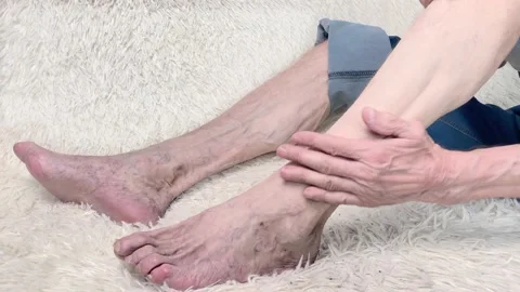 Man sitting on sofa and suffering from leg pain. Ankle disease Stock Footage 170436912