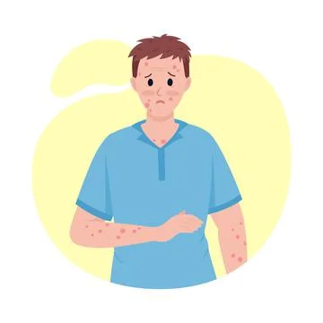 Man with skin rash semi flat color vector character Stock Illustration