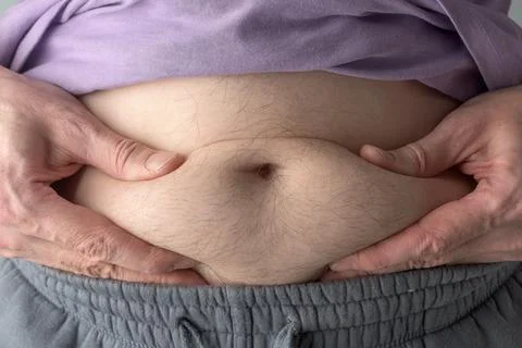 Man squeezes belly roll with both hands, close up abdomen illustrates overw.. Stock Photos