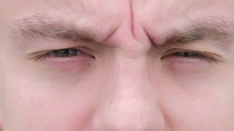 The man is squinting against the bright light. increased sensitivity of the eyes Stock Footage 132997092