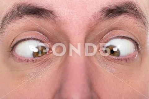 Man is squinting, closeup, concept strabismus Stock Photos