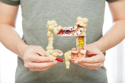 Man suffering from constipation and abdominal pain. Treatment of colitis, fla 스톡 사진